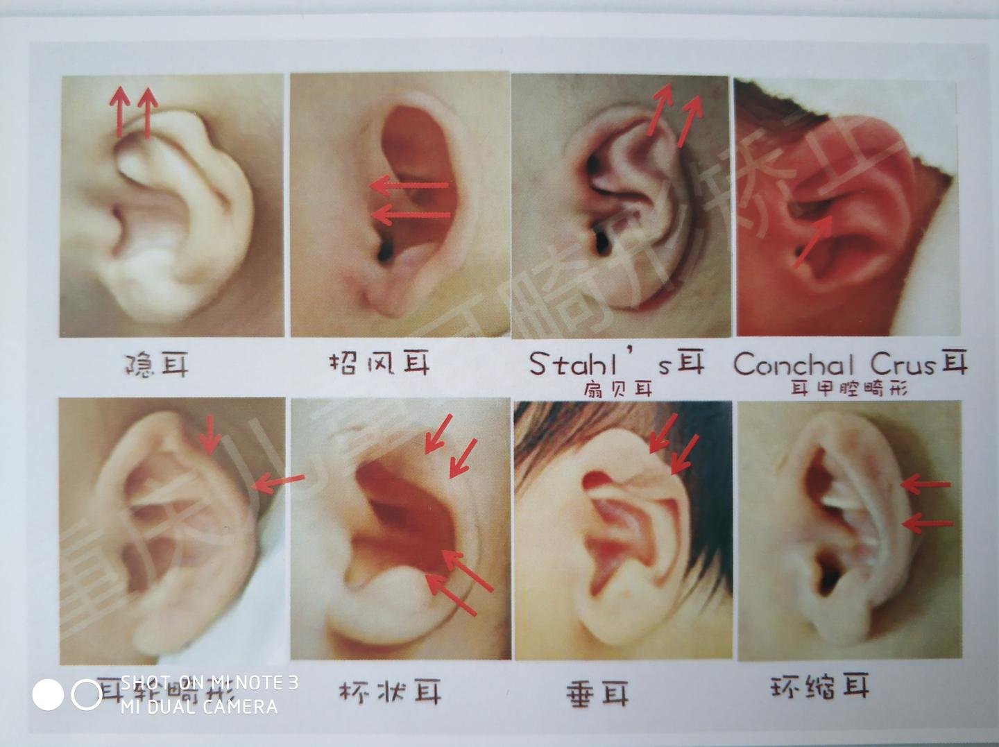 耳鼻喉申医生 67 重庆医科大学临床医学硕士 2人 赞同了该文章
