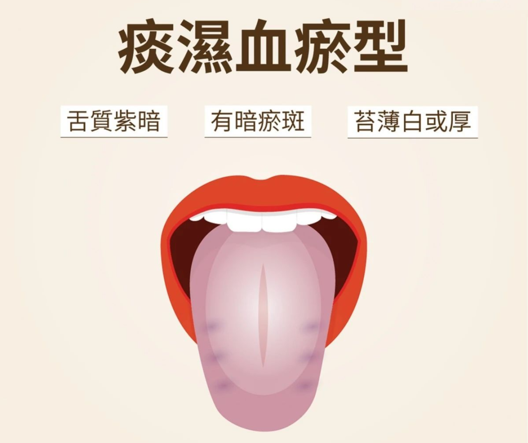 正常人的舌下照片-图库-五毛网