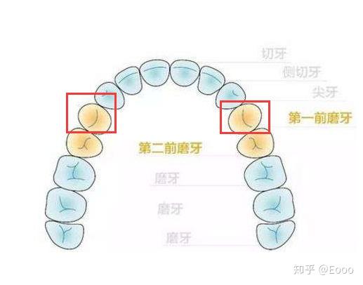 拔牙记 |四颗智齿 四颗前磨牙 附详细花费