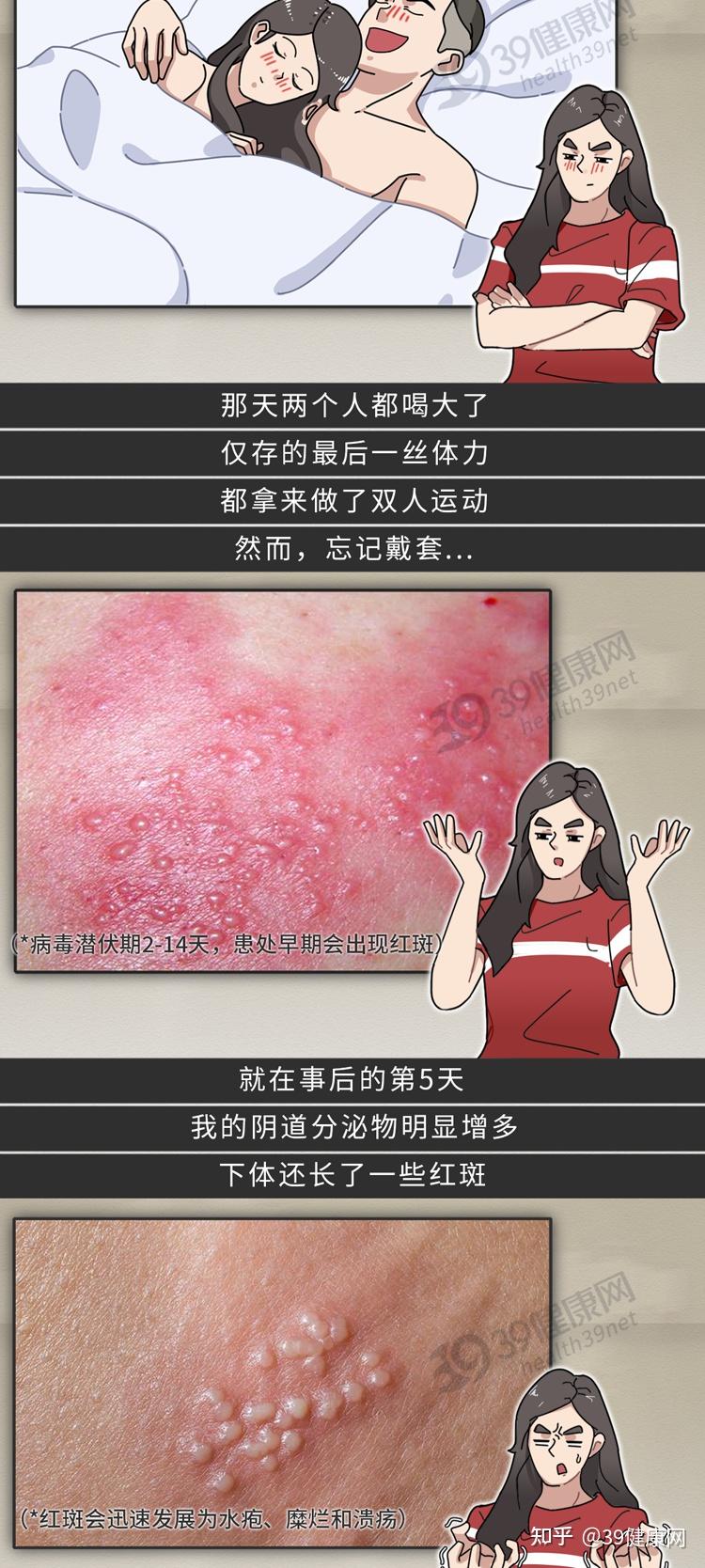 发生关系前,怎么知道对方有没有性病?