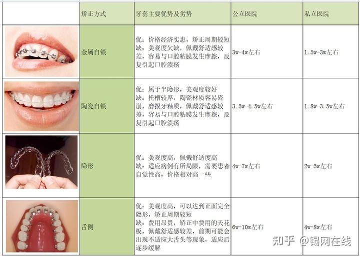 上海牙齿矫正正畸大概要花多少钱哪些口腔医院正规有没有性价比高的