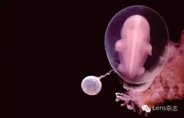 著名摄影师拍下精子进入卵子的瞬间