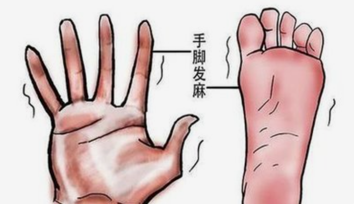 血管不通百病生,教你一招活血通络,祛瘀止痛,血管一通浑身轻松 - 知乎