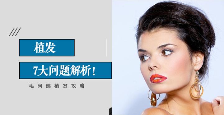 关于植发,你必须知道的这7大问题! - 知乎
