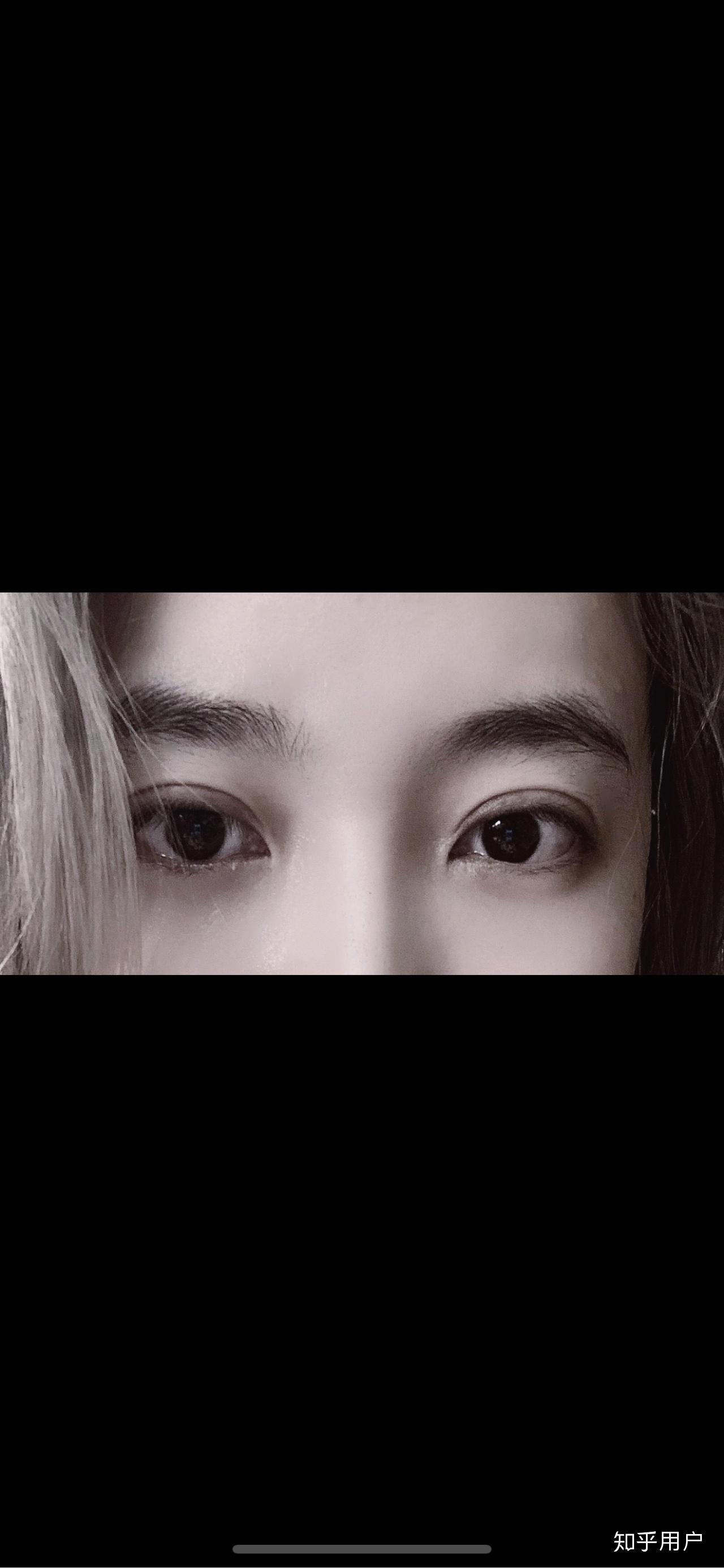 得了抑郁症的人眼神是不是都是一样的? - 知乎