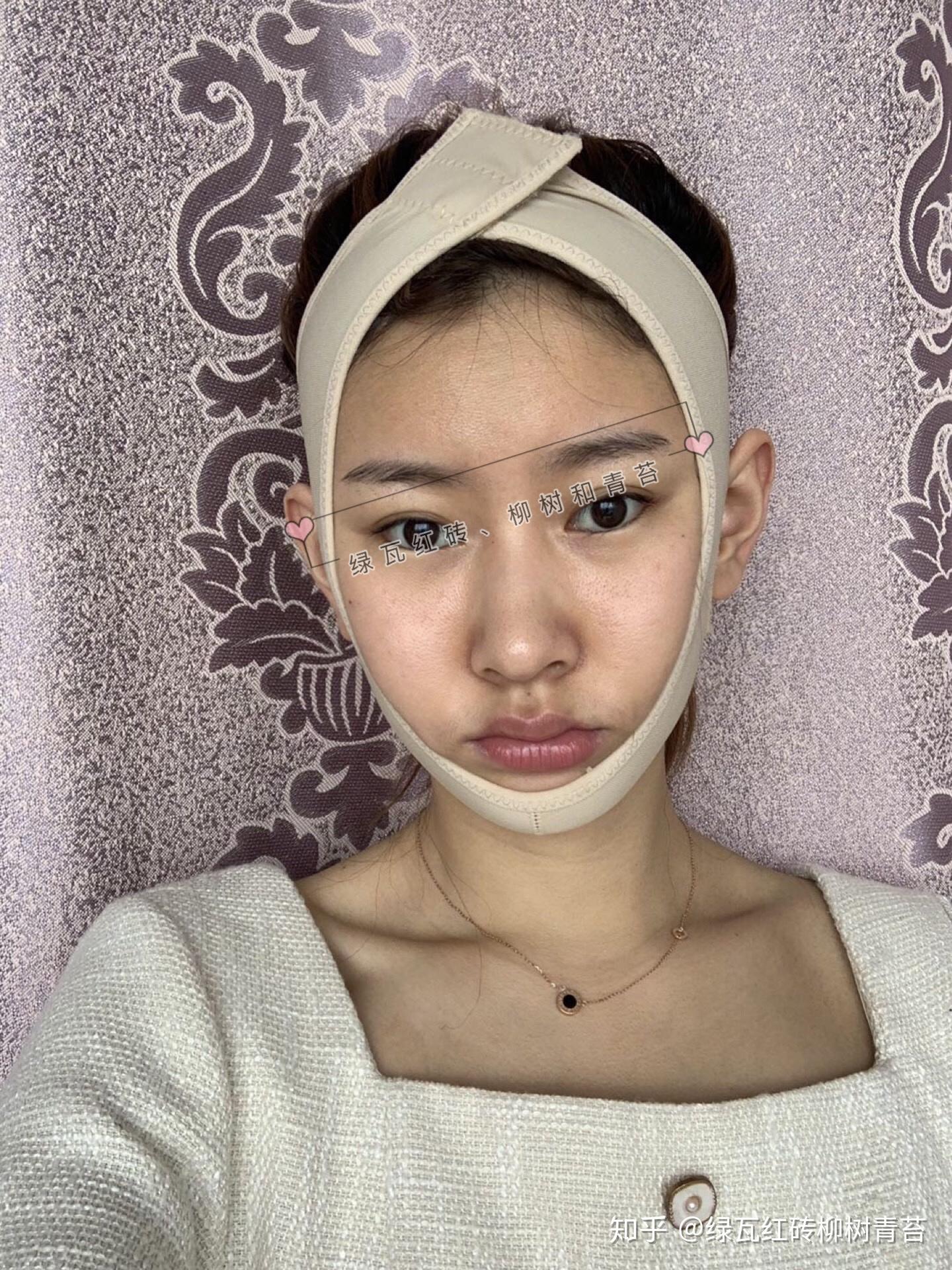 不过看到现在满大街的锥子脸,一刀切,特别丑,说实话目前为止还没有