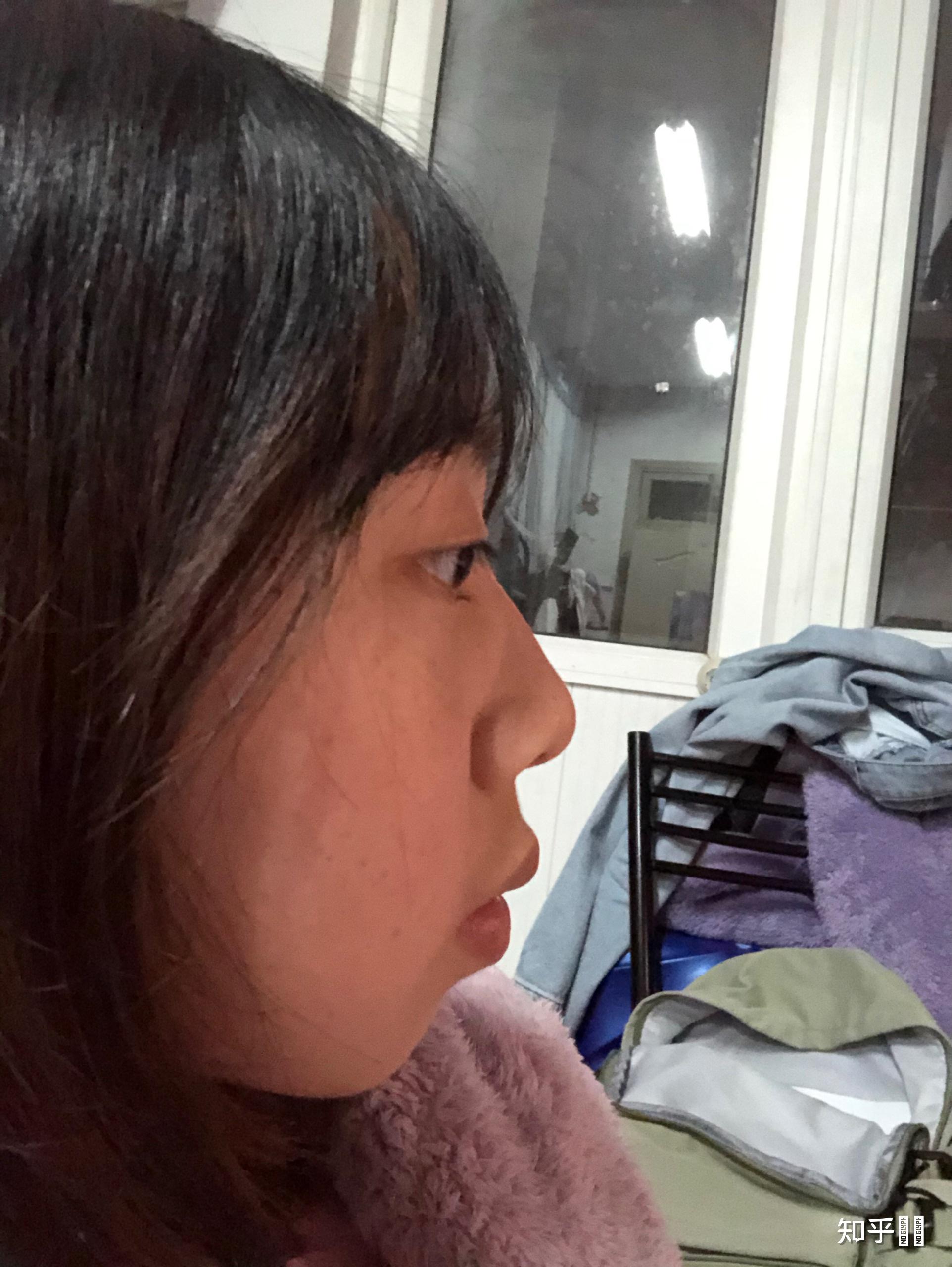 嘴巴凸应该怎么办啊啊啊