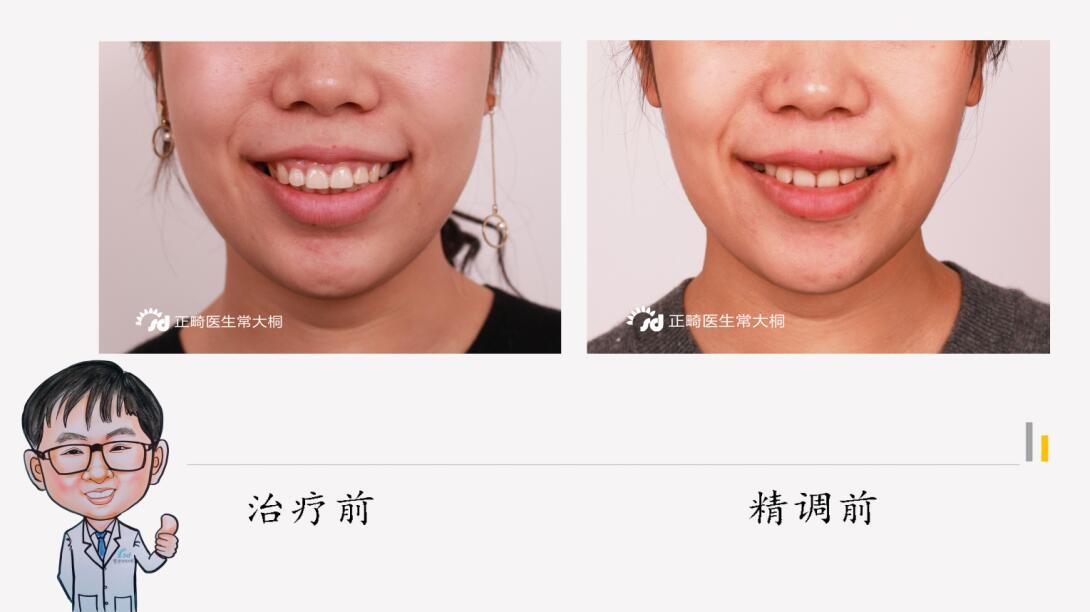 v2-fb5fd6de5cf811864dac1fddabcea2d1_1440w.jpg?source=172ae18b