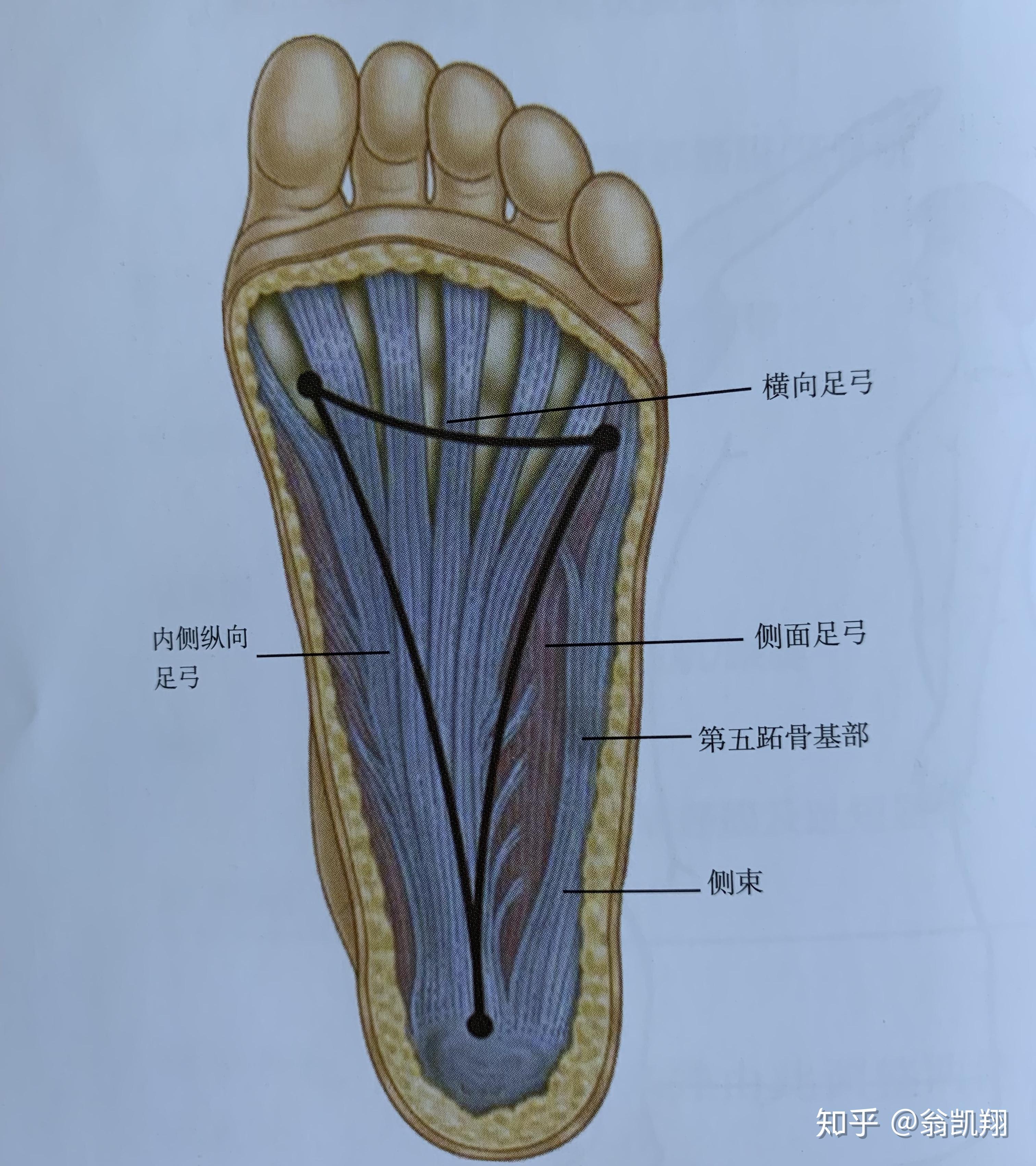 筋膜炎的位置示意图图片