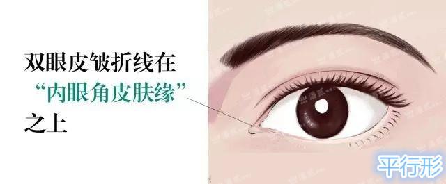 双眼皮修复时对内外高位疤痕的处理?