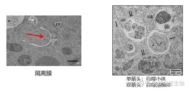 细胞自噬看这篇：发生机制/检测方法/研究思路！看完全明白！ - 知乎