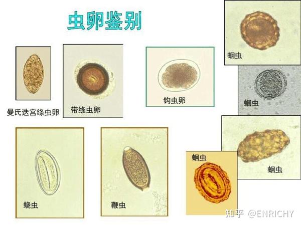 どうすれば寄生虫感染を防ぐことができるのでしょうか?