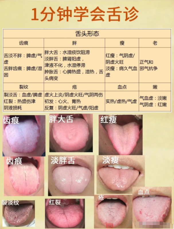 1分钟学会舌诊，老中医总结的心血，其实很简单，认真多看几遍，不会也会了！！！ - 知乎