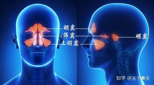 什么叫副鼻窦炎 zhuanlan.zhihu.com