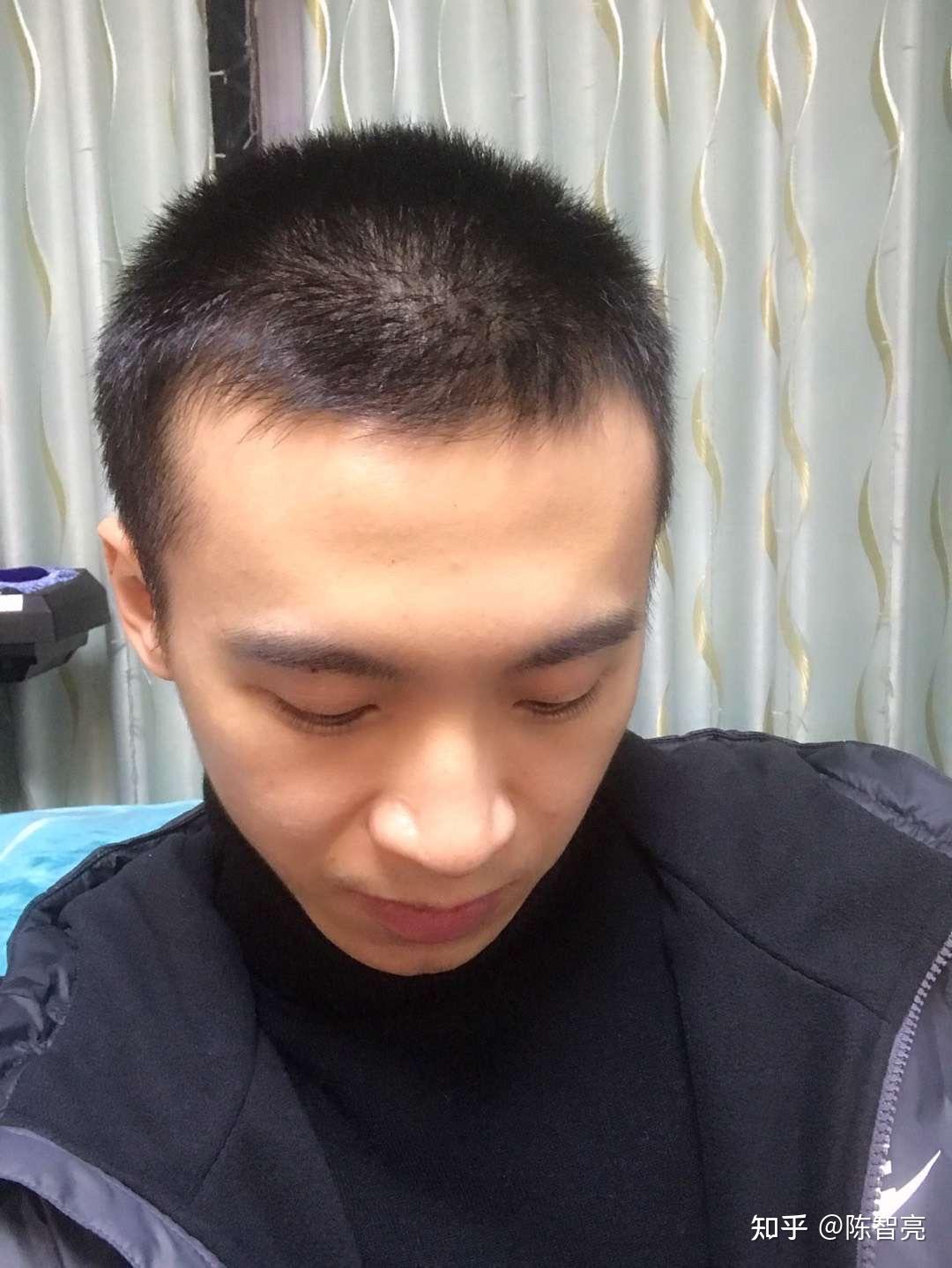 男生寸头可以有多丑? - 知乎