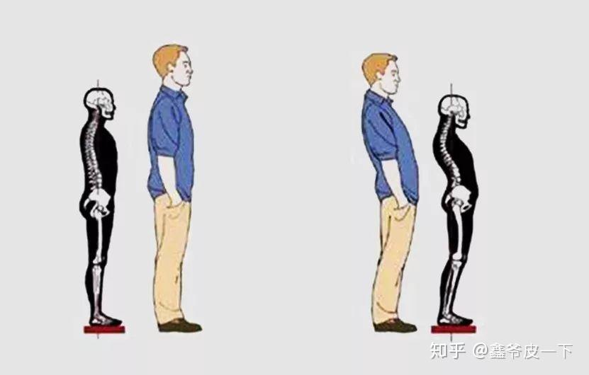 "腰椎前凸"这些骨性的体态问题;我们能看出的问题只是:挺肚子