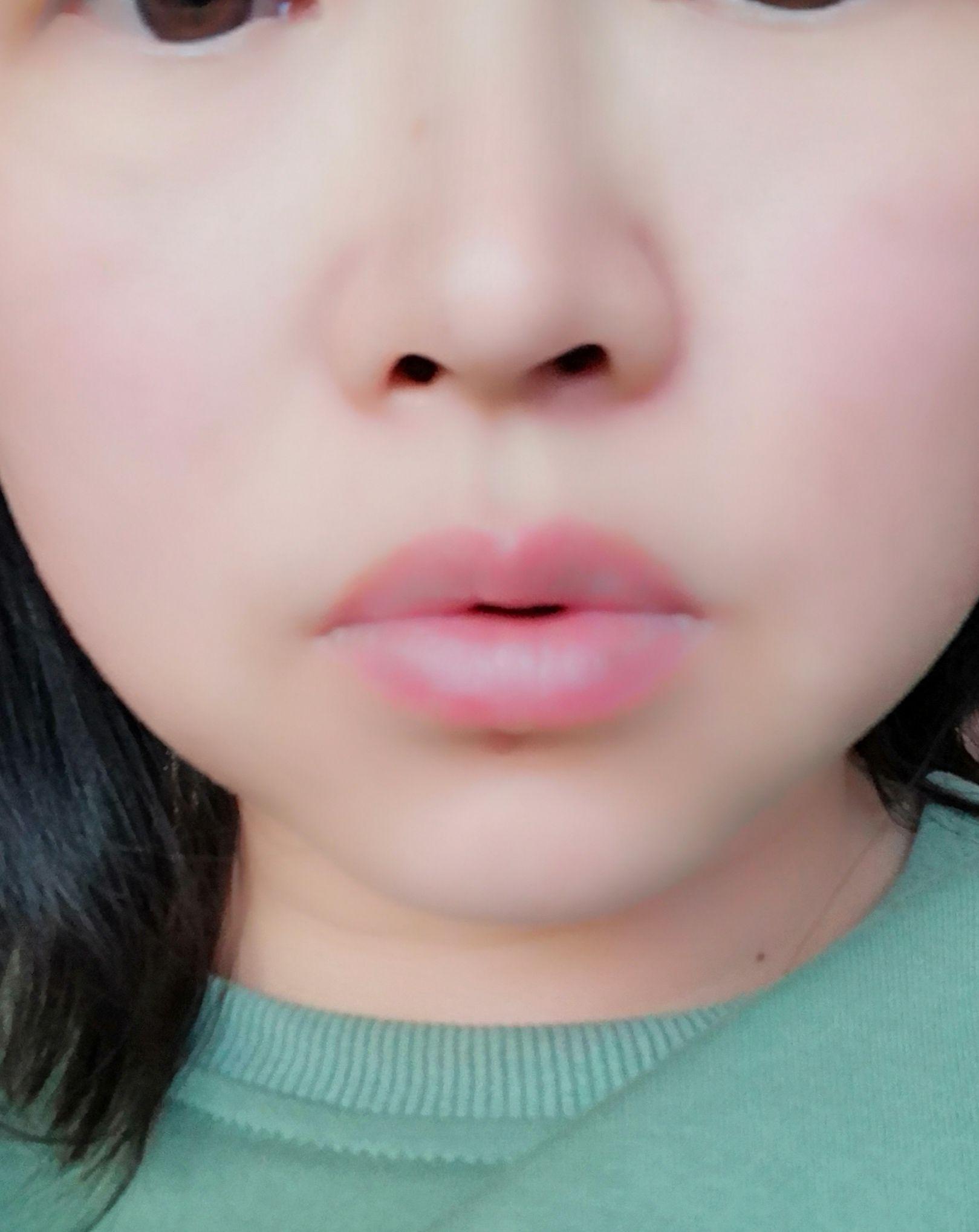 上唇翘是不是很难看啊,有没有上唇翘的小伙伴? - 知乎