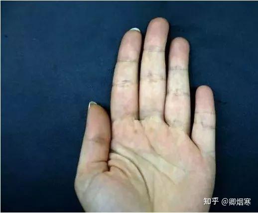 伸出你的无名指与小指，就能看出你是怎样的人！ - 知乎