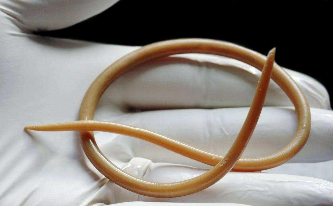 四川疑似发现非洲龙线虫已上报当地疾控中心龙线虫是什么虫对人体有害