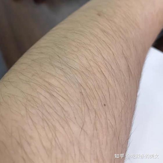 这是我的胳膊:这是我的腿:先声明:本文照片均是原相机无滤镜,现实生活