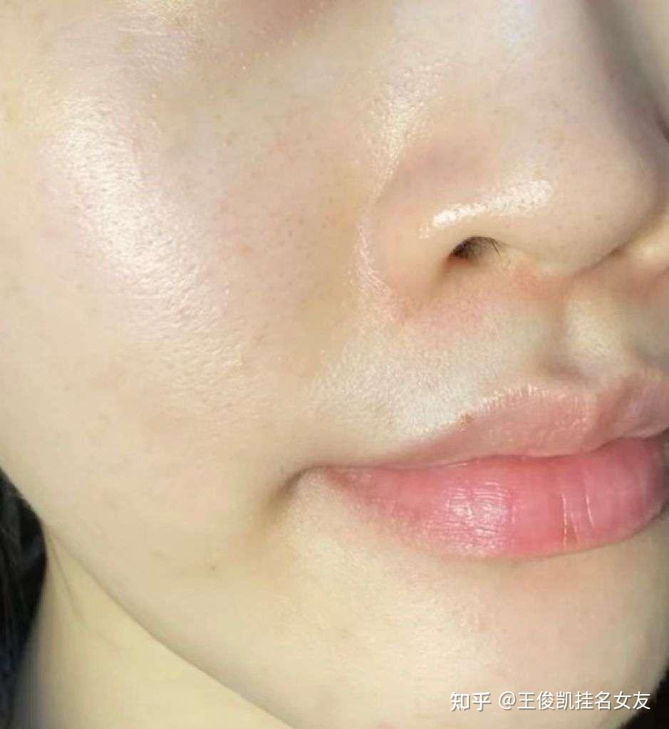 垮脸干纹怎么办有没有特别顶的抗老精华推荐