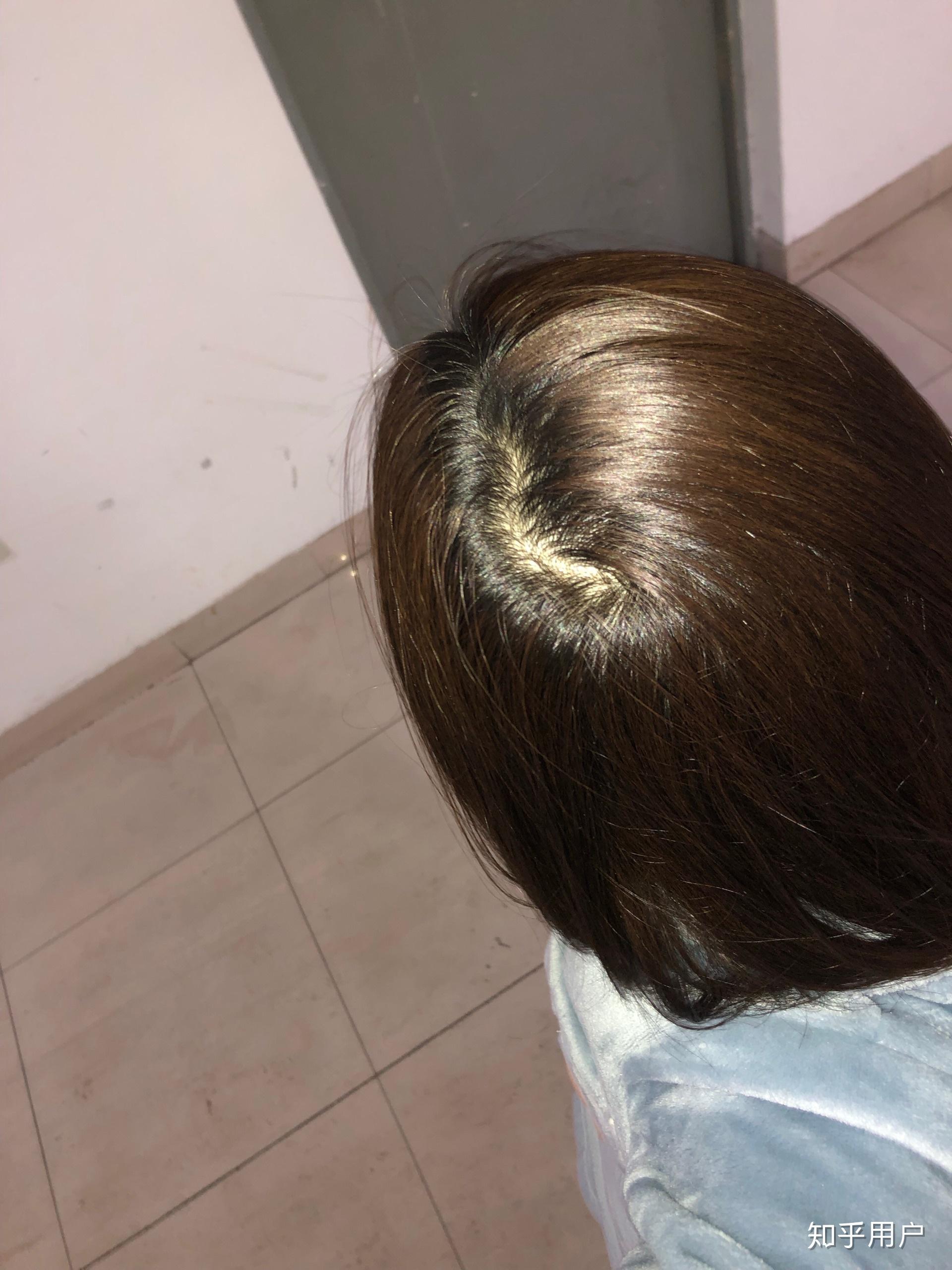风险!女生头顶头发稀少"怀南方 宝"-第2张图片-空竹博客