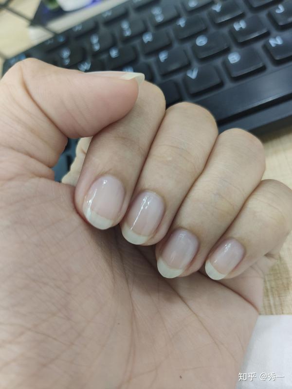 记录养指甲游离线的帖子 - 知乎