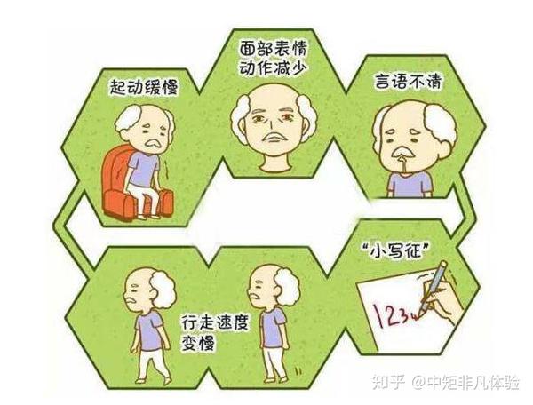 帕金森的9个早期症状表现 - 知乎