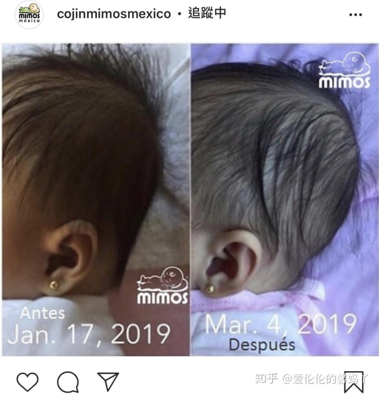 杜绝扁头看看这些明星后脑勺太丑了