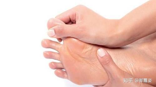 脚露姿 脚气怎么治才能除根 送你治脚气三步曲 知乎