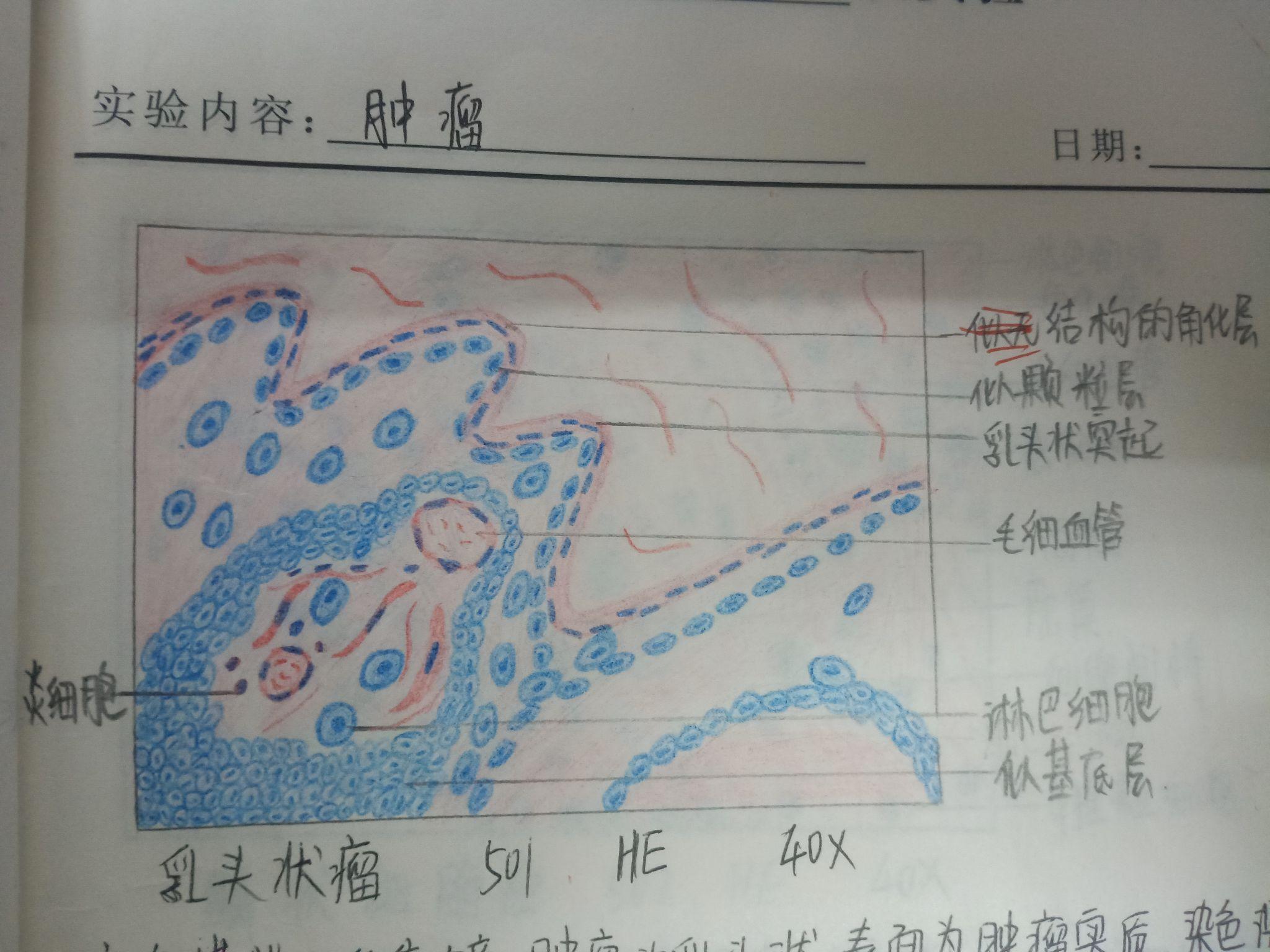 病理切片红蓝铅笔图