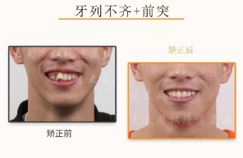 v2-fd518ce5b1fc9b5c63289efe207c7642_1440w.jpg?source=172ae18b