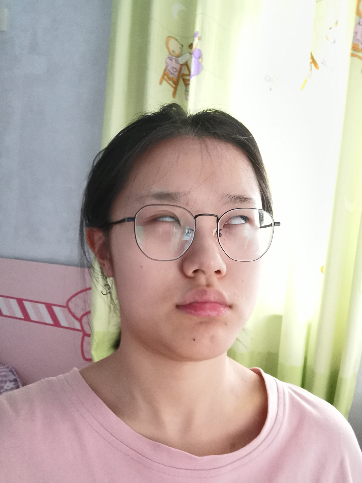 上嘴唇上翘上翻怎么办侧面看起来简直丑哭我