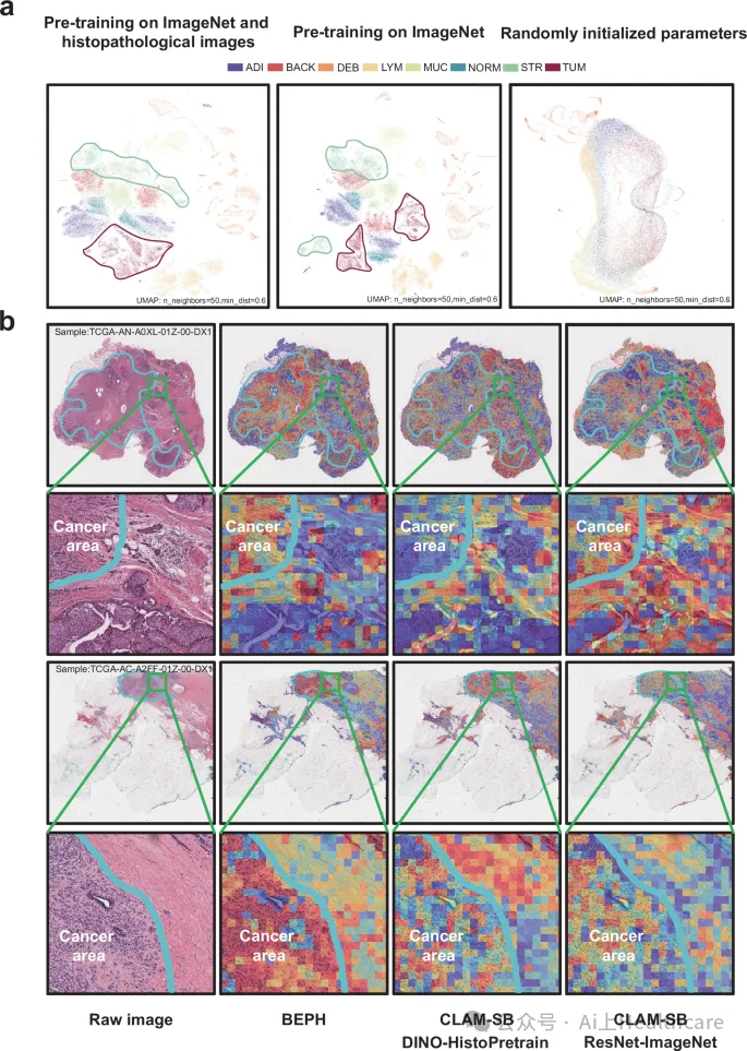 Nature Communications IF=15.7 | 突破性病理AI模型BEPH：实现多癌种诊断与生存预测的新基石 - 知乎