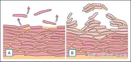 纯干货|修复肌肤屏障的五个思路 - 知乎