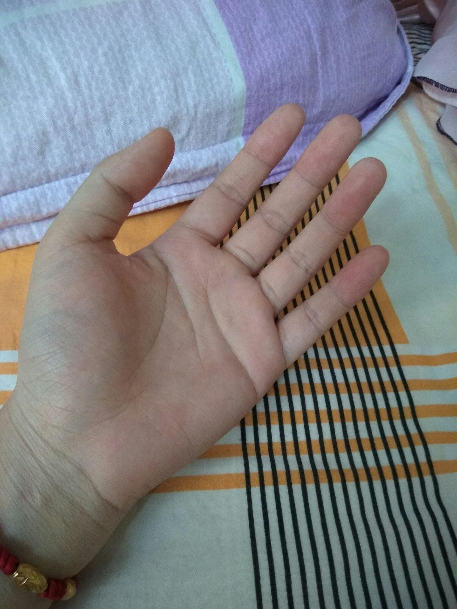 晒出你的小胖手说出小胖手给你了哪些困扰