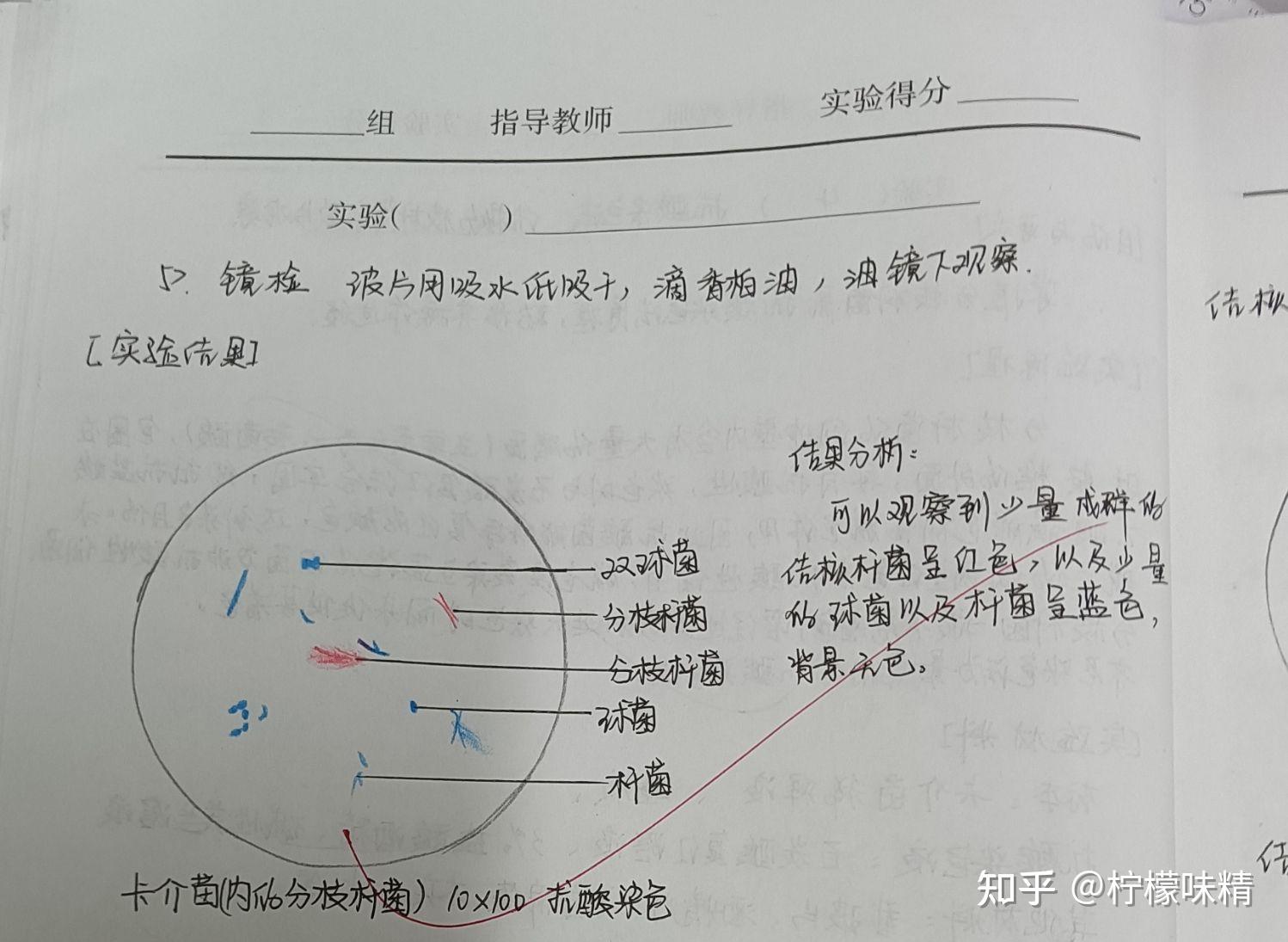 大腸埃希菌3.炭疽芽胞桿菌芽胞2.霍亂弧菌單鞭毛1.