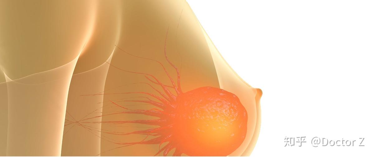 美国fda批准ado恩星曲妥珠单抗用于早期乳腺癌治疗