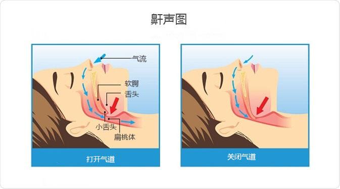 打呼噜原理图片