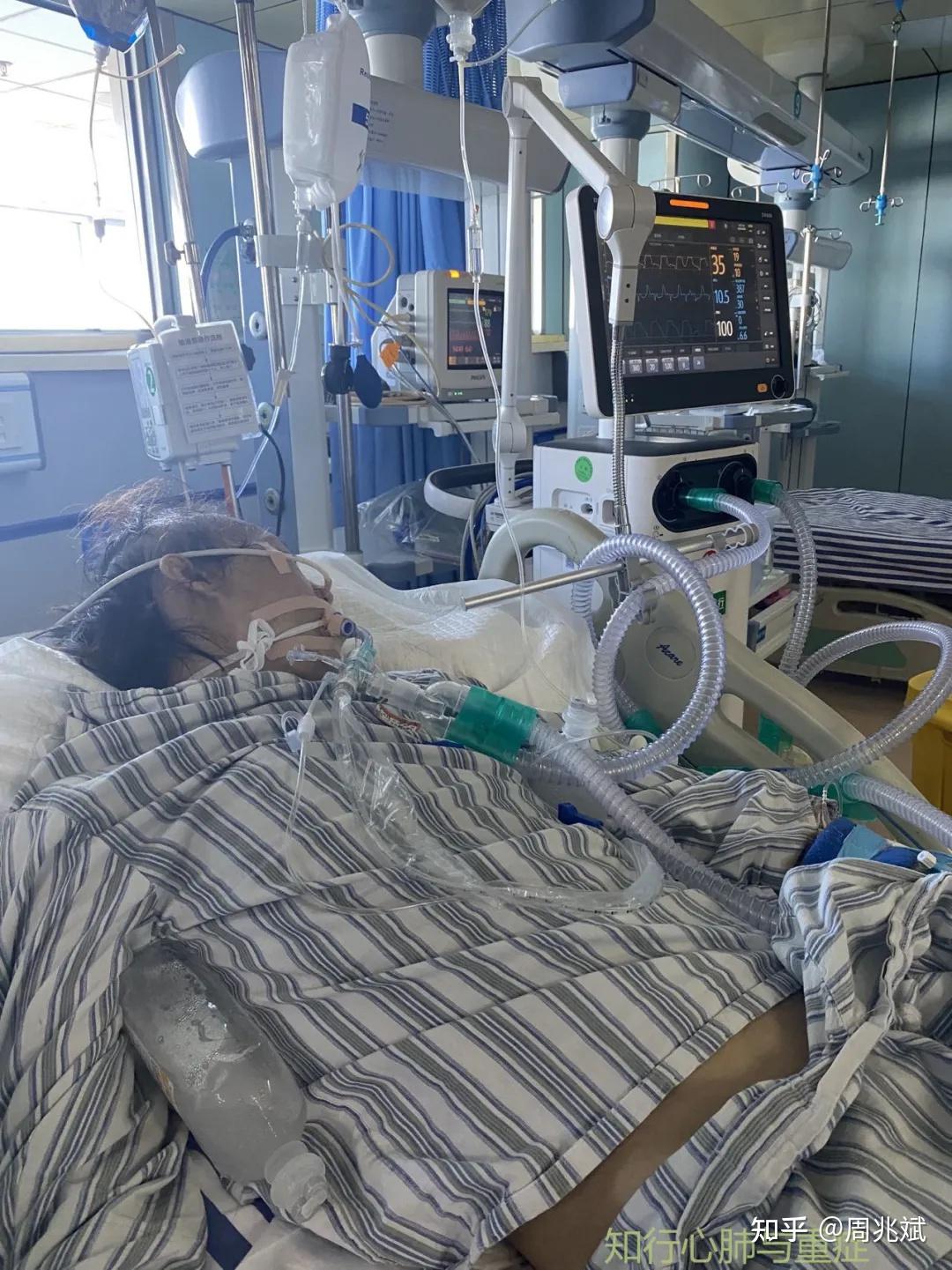 外科重症监护室icu病人的入住标准是什么