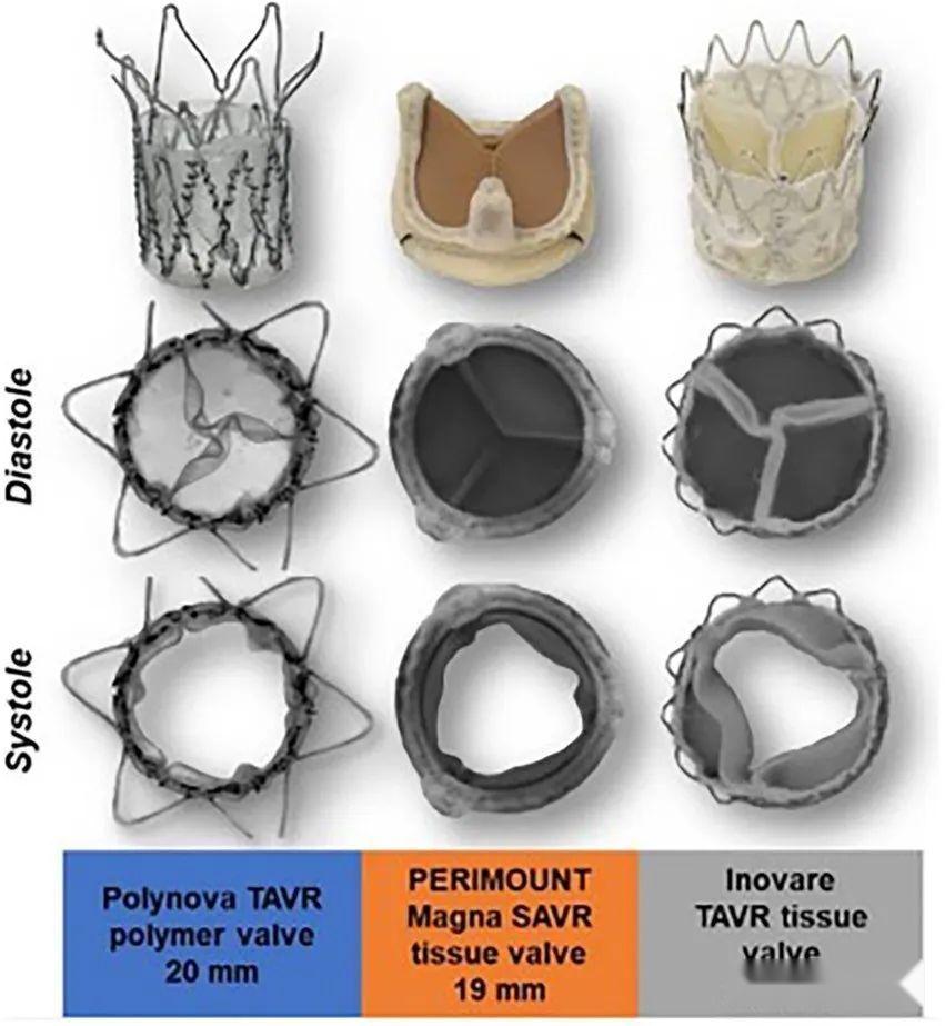 聚合物人工心脏瓣膜:当前技术与未来发展方向