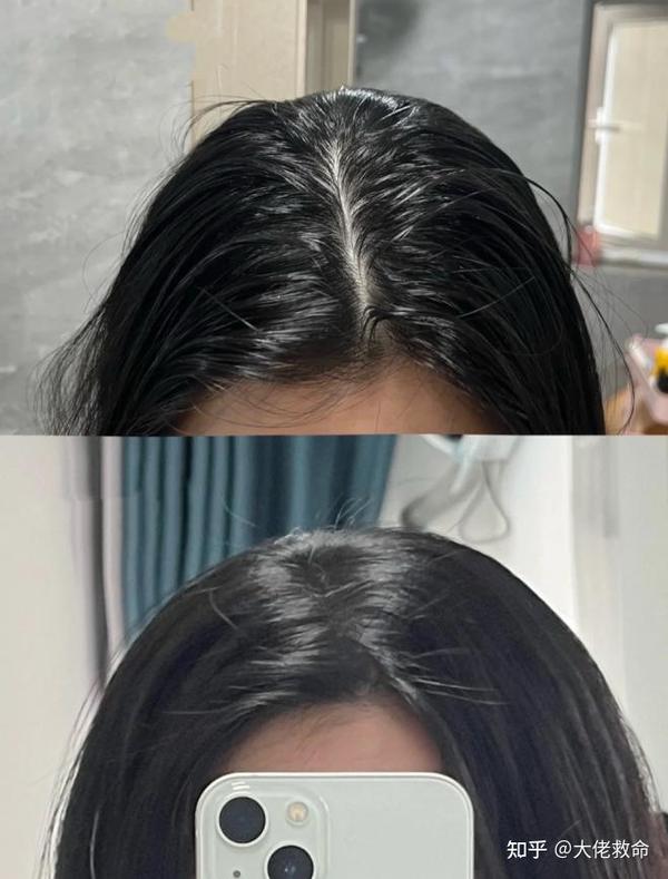 女生头发细软容易出油贴头皮,如何让头发蓬松