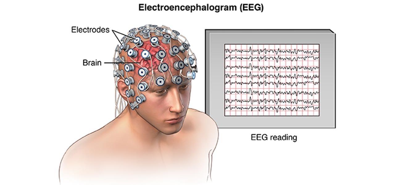 非侵入式非侵入式的脑机接口会采用头皮的脑电波信号.
