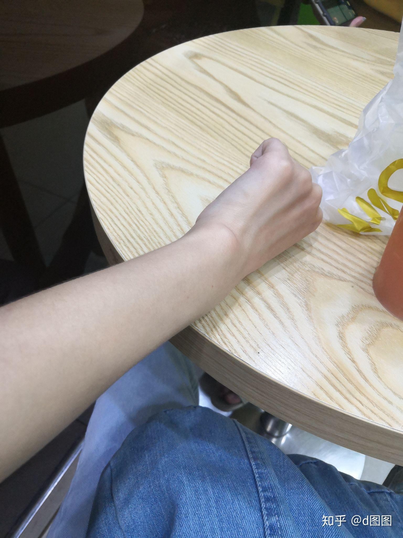 是手腕外侧靠近小指 而且左右手都有好久了按下去不痛. - 知乎