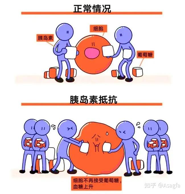 胰岛素抵抗和高胰岛素血症