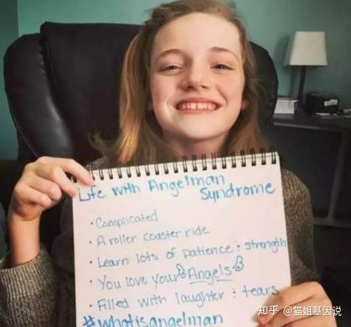 密室大逃脱 综艺里的 快乐木偶综合征 这么梦幻的名字下藏着怎样的基因问题呢 知乎