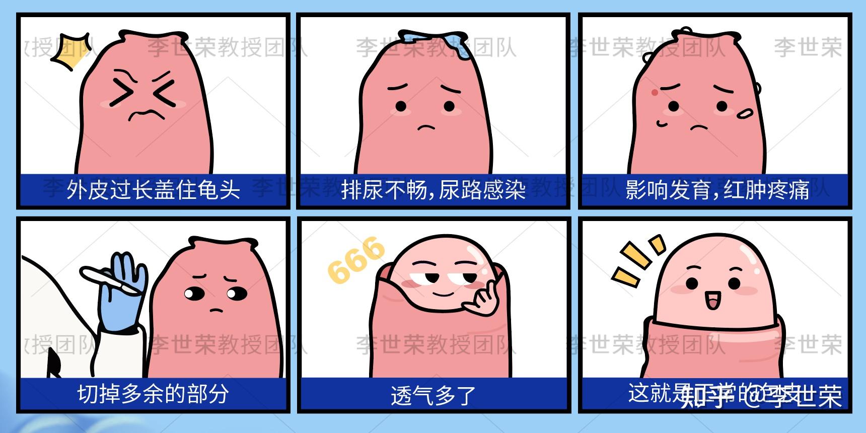 孩子的包皮该早点割还是晚点割?看完这篇给你答案 - 知乎