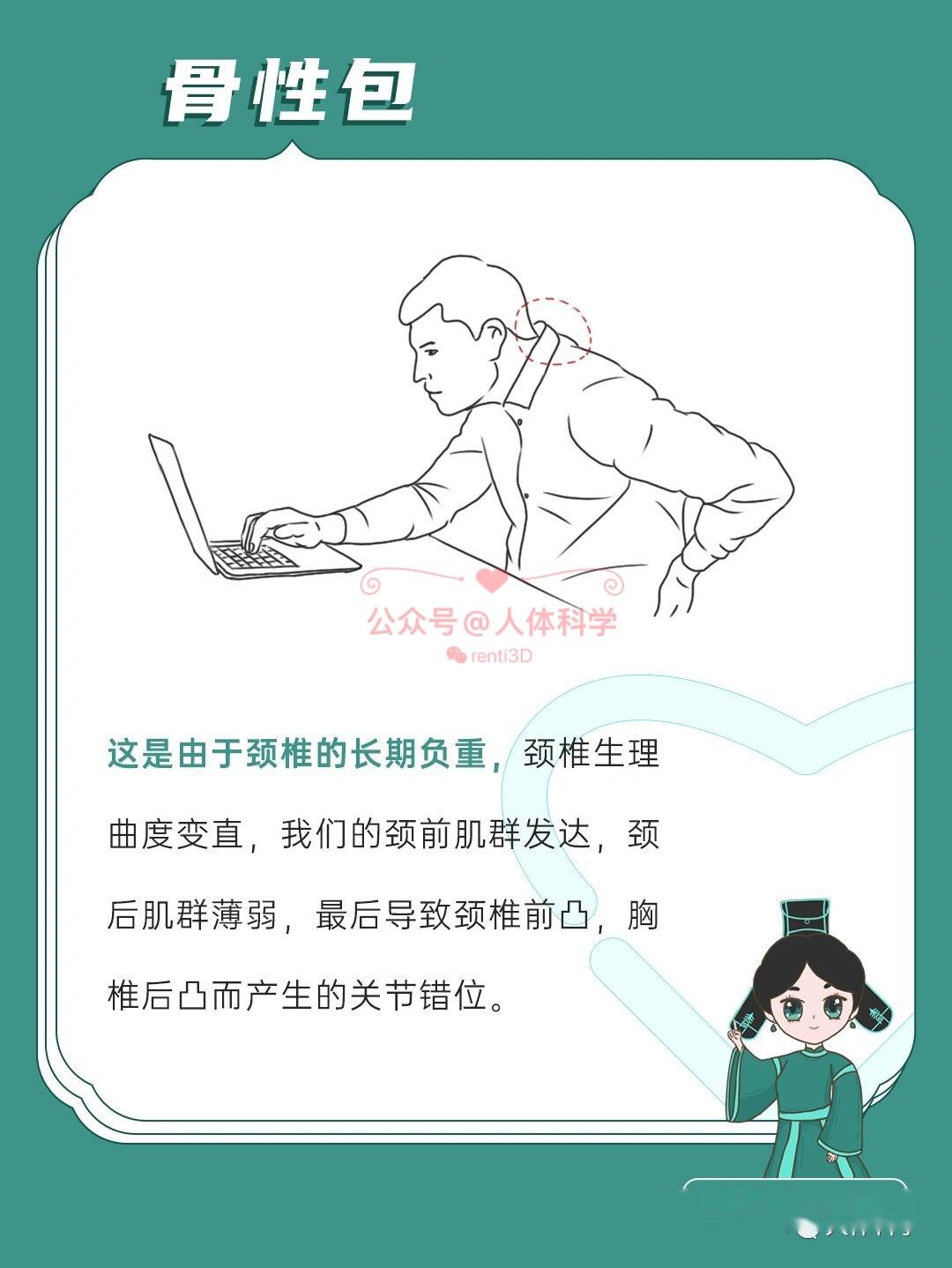 14什么是富贵包14"富贵包"指的是在后背上部颈