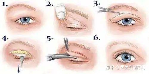 如何让眼睛更大点 v2-fe9bbbe547a7d07b2c737cc15eb43dd8_r.jpg