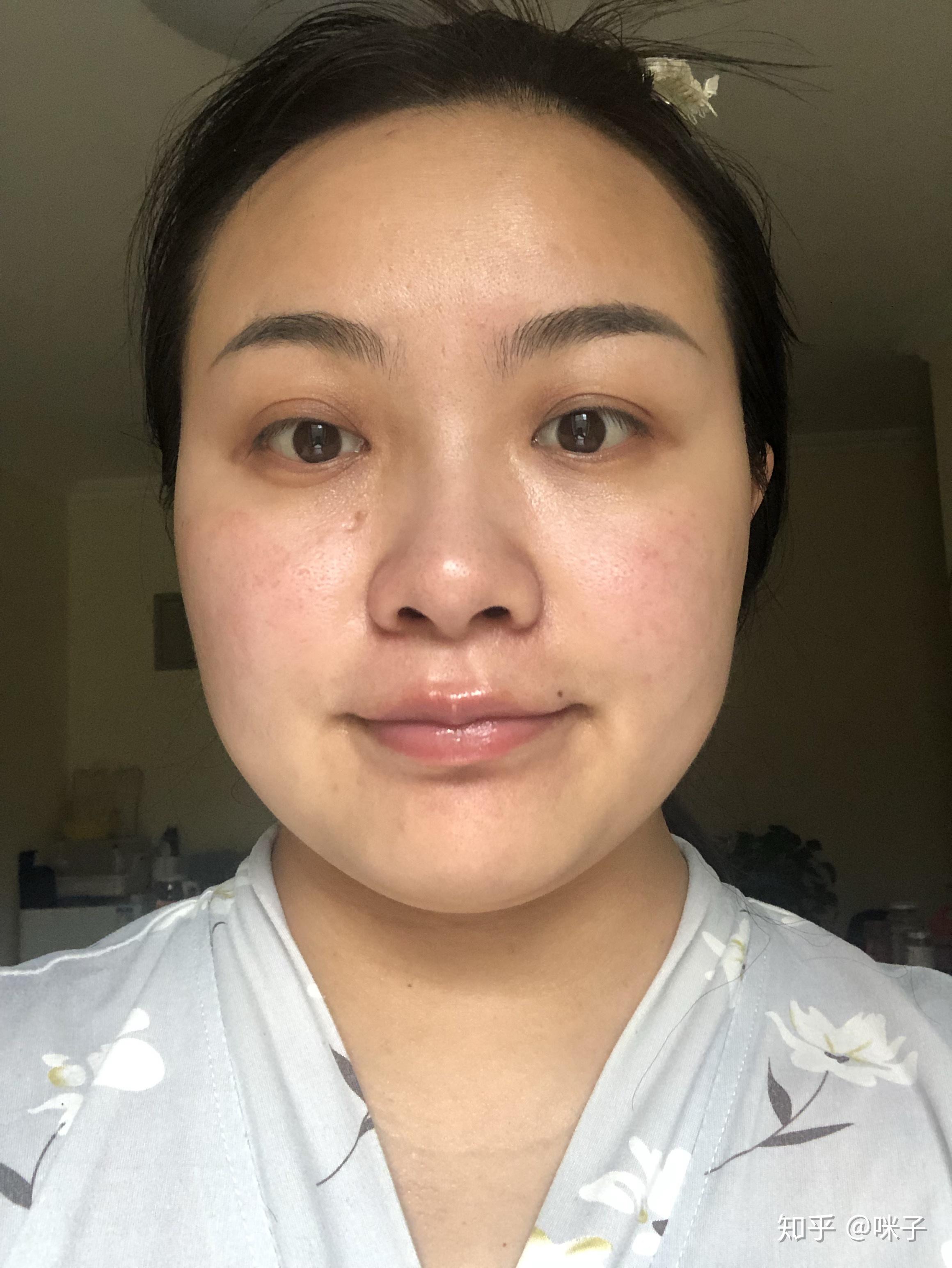 30岁的女性皮肤状态都是什么样的不要滤镜